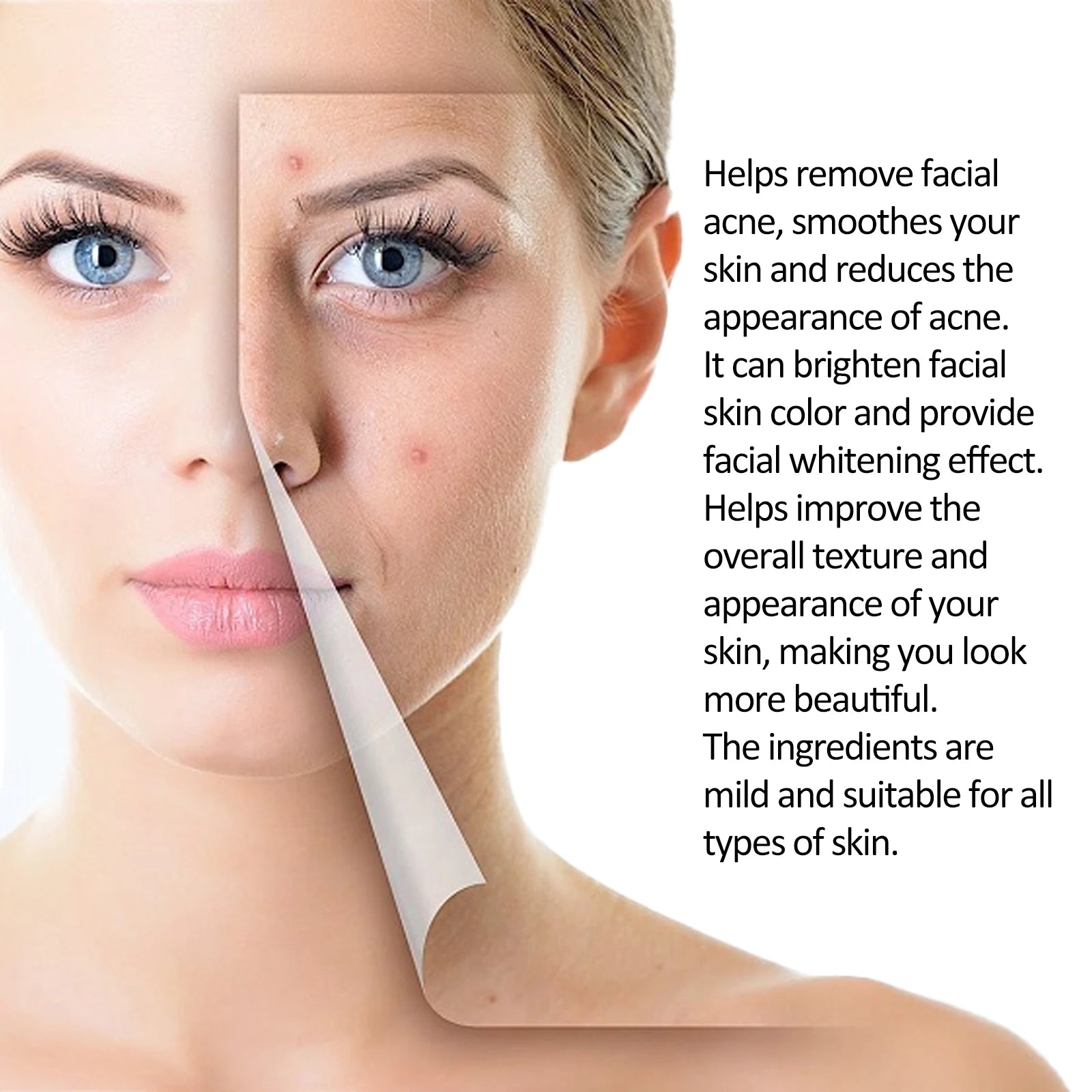 EELHOE Tea Tree Anti-Acne Essence