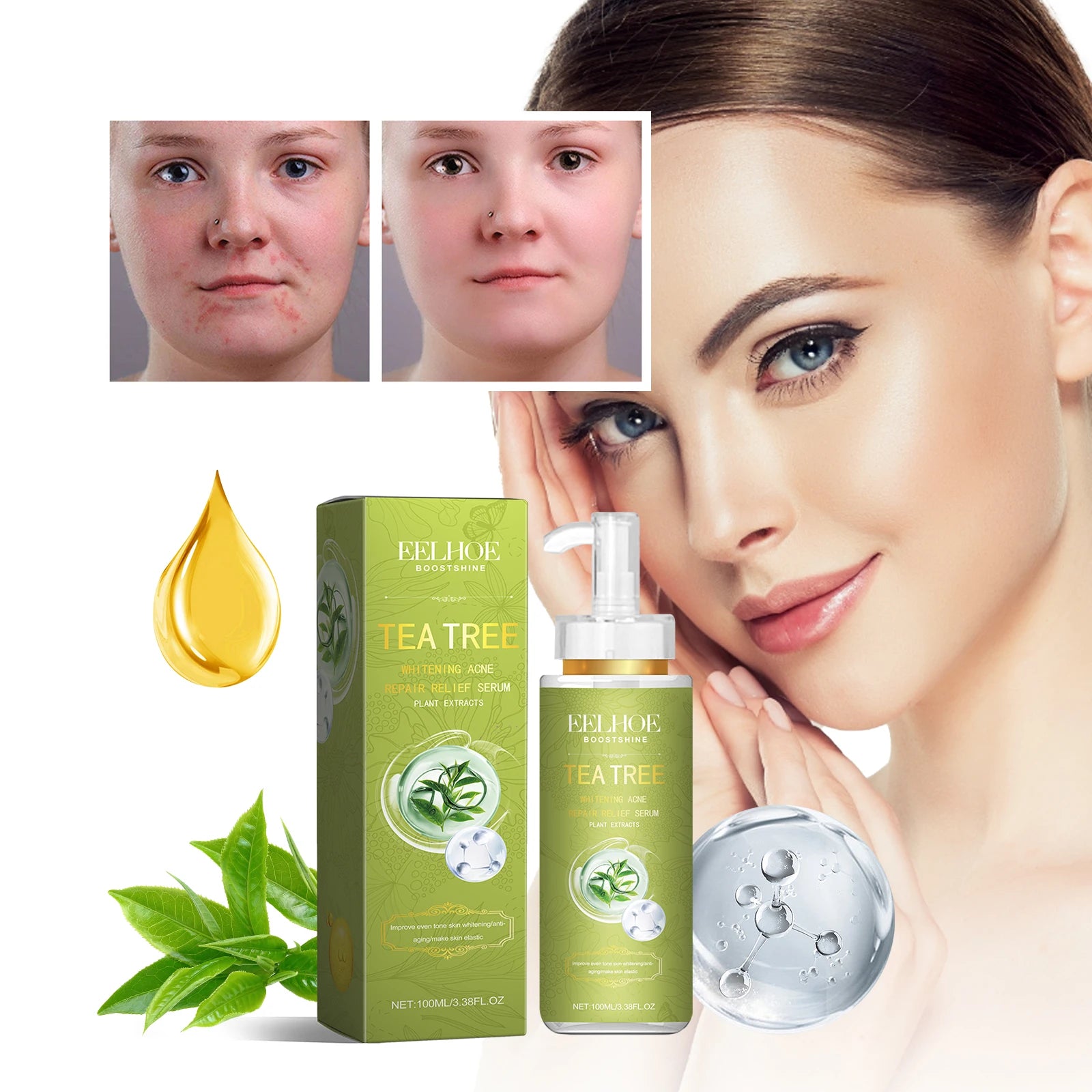EELHOE Tea Tree Anti-Acne Essence
