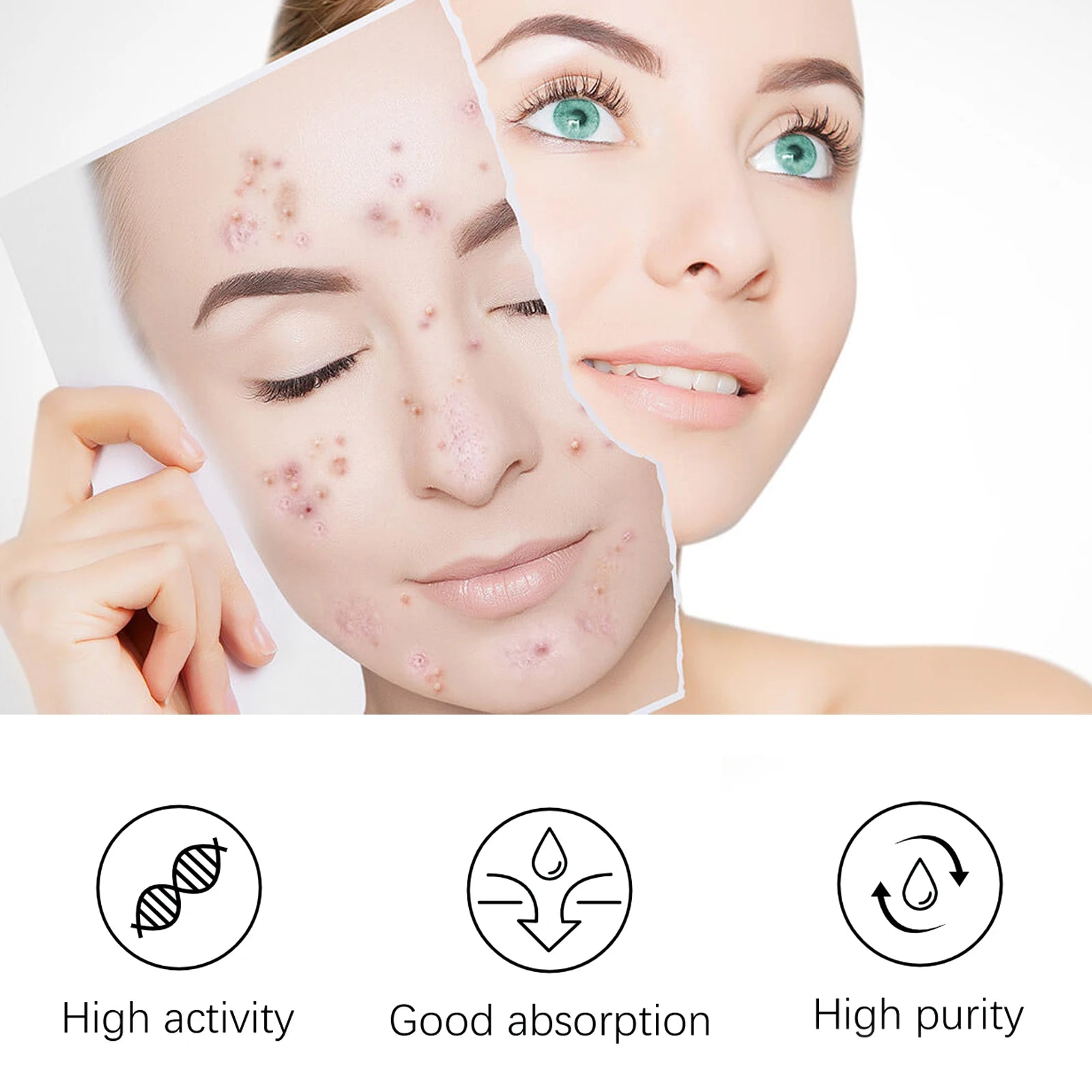 EELHOE Tea Tree Anti-Acne Essence