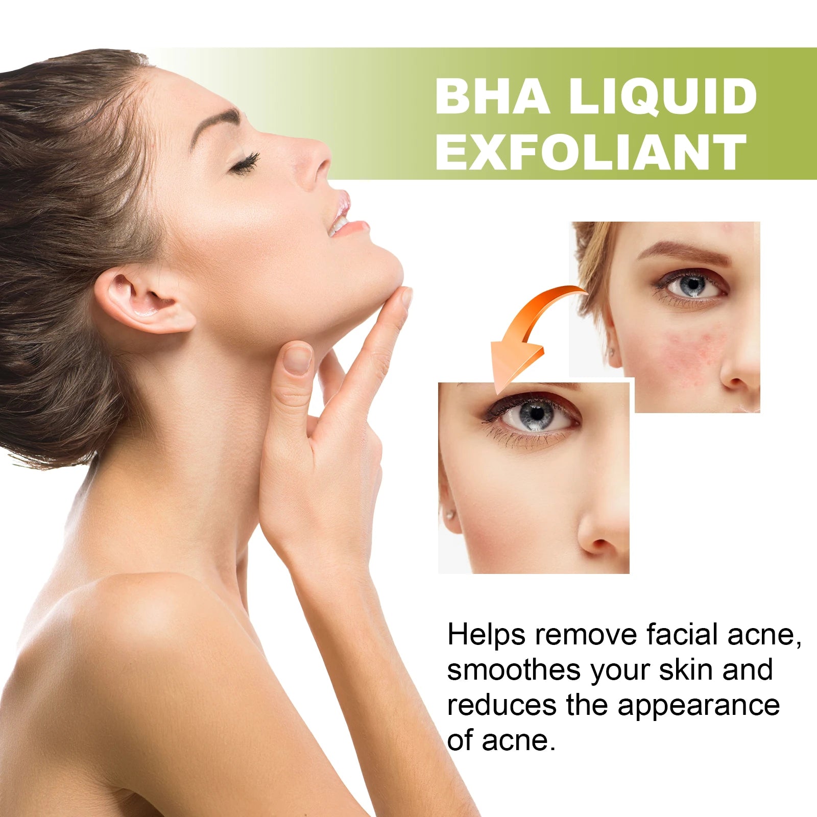 EELHOE Tea Tree Anti-Acne Essence