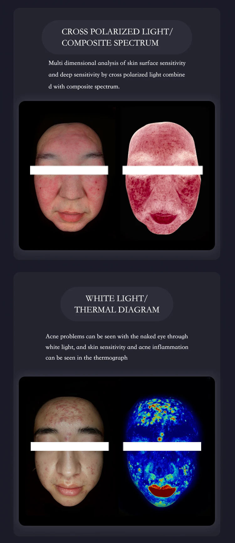 Magic Mirror Facial Skin Analyzer