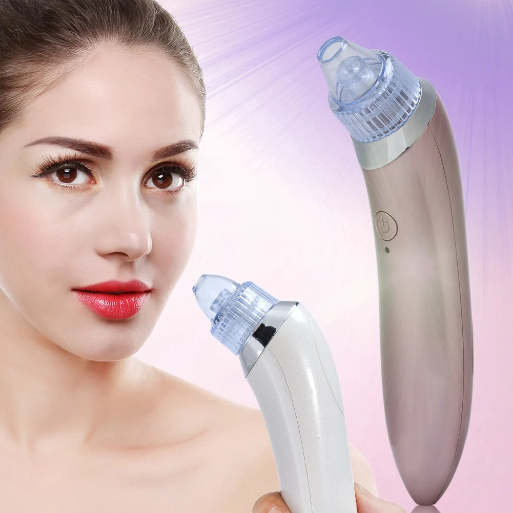 2-Color Electric Blackhead Remover Vacuum