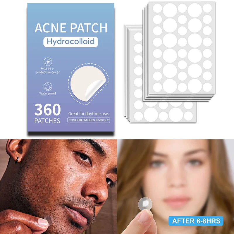 360pcs Invisible Hydrocolloid Acne Patches