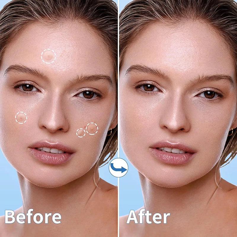 360pcs Invisible Hydrocolloid Acne Patches