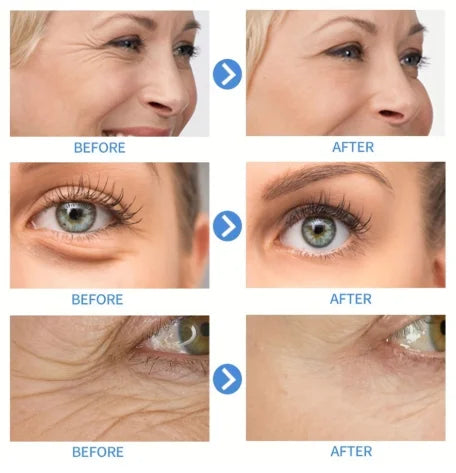 15ml Hyaluronic Acid Collagen Face Essence