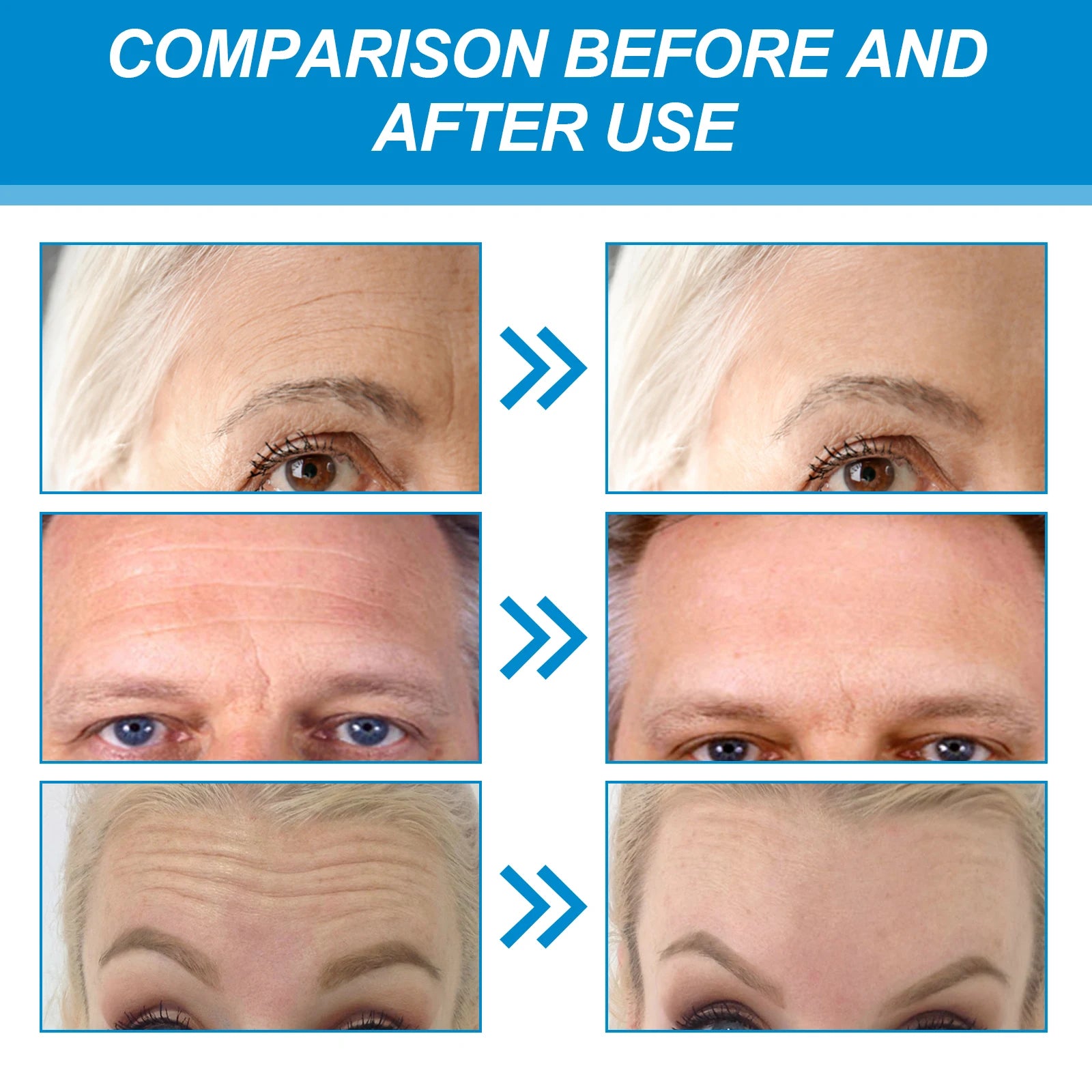 Hydrogel Anti-Wrinkle Eye & Forehead Patches