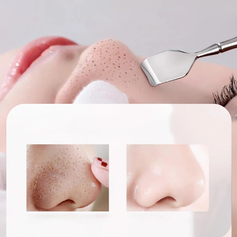 Double-Ended Blackhead & Acne Remover Tool